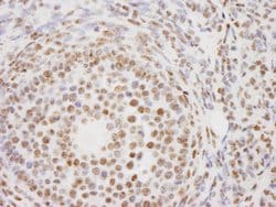 PELP1/MNAR Polyclonal Antibody, Bethyl Laboratories 100 &mu;L; Unconjugated:Antibodies,
