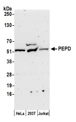PEPD Polyclonal Antibody, Bethyl Laboratories:Antibodies:Primary Antibodies