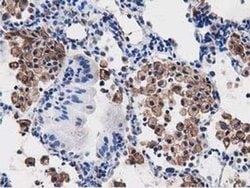 PEPD Monoclonal Antibody (OTI5D5), TrueMAB , OriGene 100 &mu;L; Unconjugated:Antibodies,