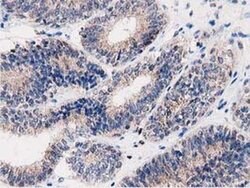 PEPD Monoclonal Antibody (OTI5D5), TrueMAB , OriGene 100 &mu;L; Unconjugated:Antibodies,