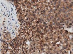 PEPD Mouse anti-Human, Clone: OTI1B7, lyophilized, TrueMAB 100 &mu;g; Unconjugated:Antibodies,