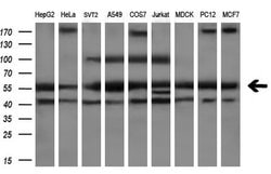 PEPD Monoclonal Antibody (OTI5D5), TrueMAB , OriGene 100 &mu;L; Unconjugated:Antibodies,