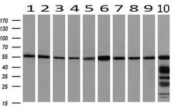 PEPD Mouse anti-Human, Clone: OTI1B7, lyophilized, TrueMAB 100 &mu;g; Unconjugated:Antibodies,