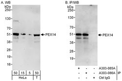 PEX14 Rabbit anti-Human, Polyclonal, Bethyl Laboratories 100 &mu;l; Unlabeled:Antibodies,