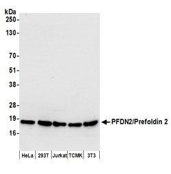 PFDN2/Prefoldin 2 Polyclonal Antibody, Bethyl Laboratories:Antibodies:Primary
