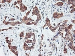 PFDN6 Mouse anti-Human, Clone: OTI4E10, lyophilized, TrueMAB 100 &mu;g;