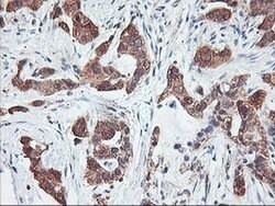 PFDN6 Monoclonal Antibody (OTI4E10), TrueMAB , OriGene 30 &mu;L; Unconjugated:Antibodies,