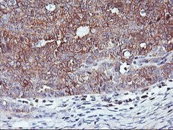 PFDN6 Mouse anti-Human, Clone: OTI4E10, lyophilized, TrueMAB 100 &mu;g;