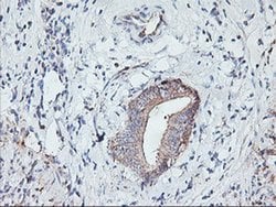 PFDN6 Monoclonal Antibody (OTI4E10), TrueMAB , OriGene 30 &mu;L; Unconjugated:Antibodies,