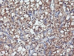 PFDN6 Mouse anti-Human, Clone: OTI4E10, lyophilized, TrueMAB 100 &mu;g;