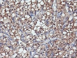 PFDN6 Monoclonal Antibody (OTI4E10), TrueMAB , OriGene 30 &mu;L; Unconjugated:Antibodies,