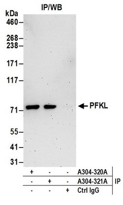 PFKL Rabbit anti-Human, Polyclonal, Bethyl Laboratories 100 &mu;l; Unlabeled:Antibodies,