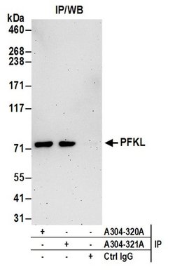 PFKL Rabbit anti-Human, Polyclonal, Bethyl Laboratories 10 &mu;L; Unconjugated:Antibodies,