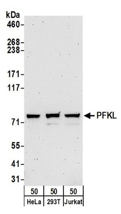 PFKL Rabbit anti-Human, Polyclonal, Bethyl Laboratories 100 &mu;l; Unlabeled:Antibodies,