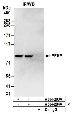PFKP Rabbit anti-Human, Polyclonal, Bethyl Laboratories 10 &mu;L; Unconjugated:Antibodies,