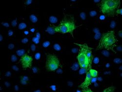 PFKP Mouse anti-Human, Clone: OTI1F2, lyophilized, TrueMAB 100 &mu;g; Unconjugated:Antibodies,