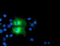 PFKP Mouse anti-Human, Mouse, Rat, Clone: OTI1D6, liquid, TrueMAB 100 &mu;L;