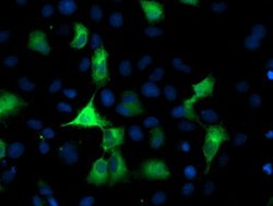 PFKP Mouse anti-Human, Clone: OTI3G8, lyophilized, TrueMAB 100 &mu;g; Unconjugated:Antibodies,