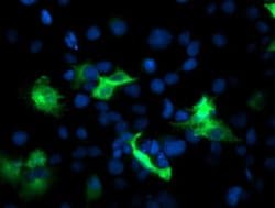 PFKP Monoclonal Antibody (OTI2E8), TrueMAB , OriGene 30 &mu;L; Unconjugated:Antibodies,