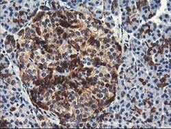 PFKP Mouse anti-Human, Clone: OTI1F2, lyophilized, TrueMAB 100 &mu;g; Unconjugated:Antibodies,
