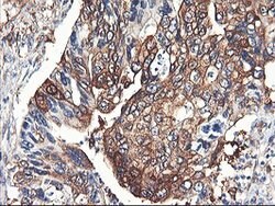 PFKP Mouse anti-Human, Clone: OTI1F2, lyophilized, TrueMAB 100 &mu;g; Unconjugated:Antibodies,