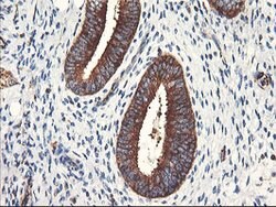 PFKP Mouse anti-Human, Clone: OTI1F2, lyophilized, TrueMAB 100 &mu;g; Unconjugated:Antibodies,