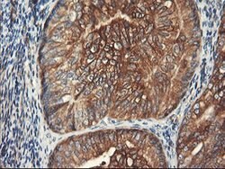 PFKP Mouse anti-Human, Clone: OTI1F2, lyophilized, TrueMAB 100 &mu;g; Unconjugated:Antibodies,