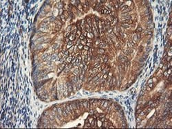 PFKP Mouse anti-Human, Clone: OTI1F2, liquid, TrueMAB 100 &mu;L; Unconjugated:Antibodies,