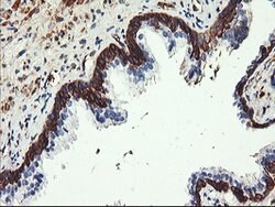 PFKP Mouse anti-Human, Clone: OTI1F2, lyophilized, TrueMAB 100 &mu;g; Unconjugated:Antibodies,