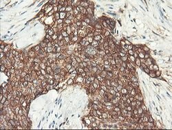 PFKP Mouse anti-Human, Clone: OTI1F2, lyophilized, TrueMAB 100 &mu;g; Unconjugated:Antibodies,