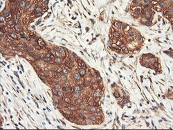 PFKP Mouse anti-Human, Clone: OTI1F2, lyophilized, TrueMAB 100 &mu;g; Unconjugated:Antibodies,