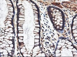PFKP Mouse anti-Human, Clone: OTI1F2, lyophilized, TrueMAB 100 &mu;g; Unconjugated:Antibodies,