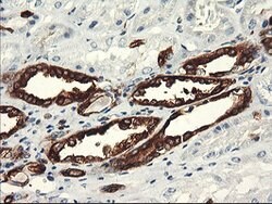 PFKP Mouse anti-Human, Clone: OTI1F2, lyophilized, TrueMAB 100 &mu;g; Unconjugated:Antibodies,