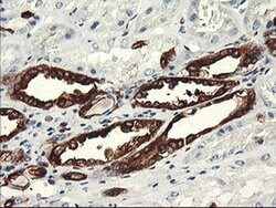 PFKP Mouse anti-Human, Clone: OTI1F2, liquid, TrueMAB 100 &mu;L; Unconjugated:Antibodies,