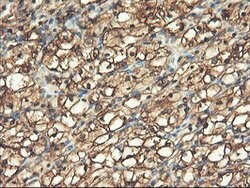 PFKP Mouse anti-Human, Clone: OTI1F2, lyophilized, TrueMAB 100 &mu;g; Unconjugated:Antibodies,