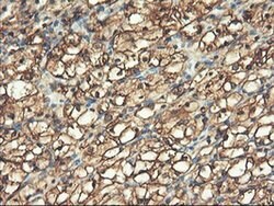 PFKP Mouse anti-Human, Clone: OTI1F2, liquid, TrueMAB 100 &mu;L; Unconjugated:Antibodies,