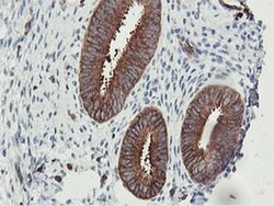 PFKP Monoclonal Antibody (OTI3A12), TrueMAB , OriGene 100 &mu;L; Unconjugated:Antibodies,
