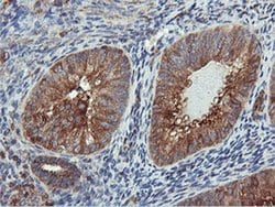 PFKP Monoclonal Antibody (OTI3A12), TrueMAB , OriGene 100 &mu;L; Unconjugated:Antibodies,