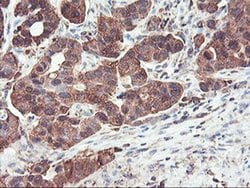 PFKP Mouse anti-Human, Mouse, Rat, Clone: OTI1D6, liquid, TrueMAB 100 &mu;L;