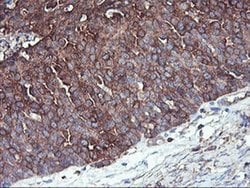 PFKP Mouse anti-Human, Mouse, Rat, Clone: OTI1D6, liquid, TrueMAB 100 &mu;L;