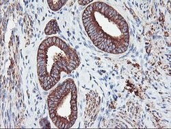PFKP Mouse anti-Human, Mouse, Rat, Clone: OTI1D6, liquid, TrueMAB 100 &mu;L;