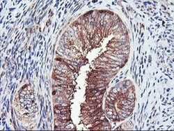 PFKP Mouse anti-Human, Mouse, Rat, Clone: OTI1D6, liquid, TrueMAB 100 &mu;L;