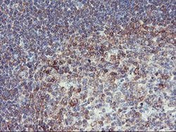 PFKP Mouse anti-Human, Mouse, Rat, Clone: OTI1D6, liquid, TrueMAB 100 &mu;L;