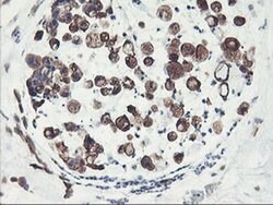 PFKP Mouse anti-Human, Mouse, Rat, Clone: OTI1D6, liquid, TrueMAB 100 &mu;L;
