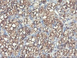 PFKP Mouse anti-Human, Mouse, Rat, Clone: OTI1D6, liquid, TrueMAB 100 &mu;L;