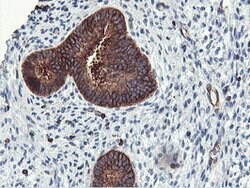 PFKP Mouse anti-Human, Clone: OTI3G8, lyophilized, TrueMAB 100 &mu;g; Unconjugated:Antibodies,
