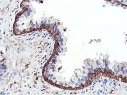 PFKP Mouse anti-Human, Clone: OTI3G8, lyophilized, TrueMAB 100 &mu;g; Unconjugated:Antibodies,