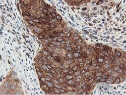 PFKP Mouse anti-Human, Clone: OTI3G8, lyophilized, TrueMAB 100 &mu;g; Unconjugated:Antibodies,