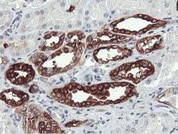 PFKP Mouse anti-Human, Clone: OTI3G8, lyophilized, TrueMAB 100 &mu;g; Unconjugated:Antibodies,