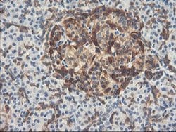 PFKP Monoclonal Antibody (OTI2E8), TrueMAB , OriGene 30 &mu;L; Unconjugated:Antibodies,